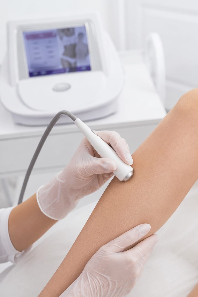 Permanent Hair Removal by Electrolysis
